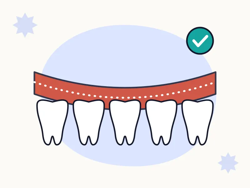 Diş Eti Tedavisi (Periodontoloji) tedavisi