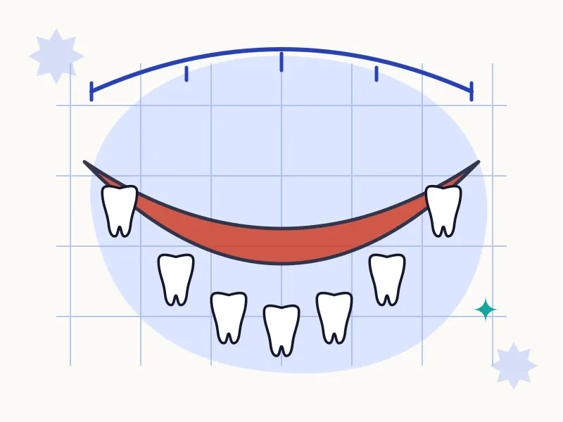 Gülüş Tasarımı (Hollywood Smile) tedavisi