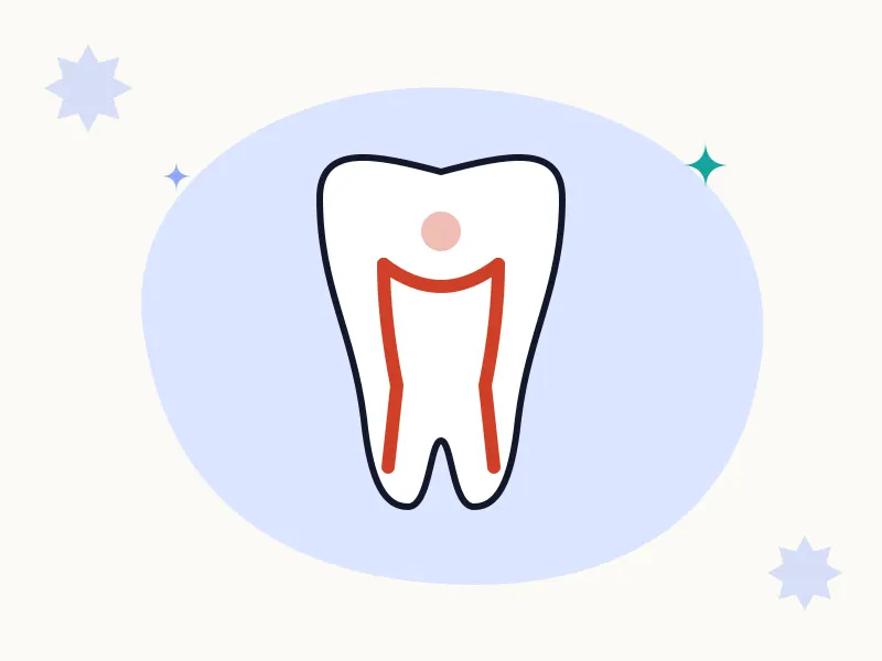 Kanal Tedavisi (Endodonti) tedavisi